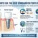 Dental implants usa